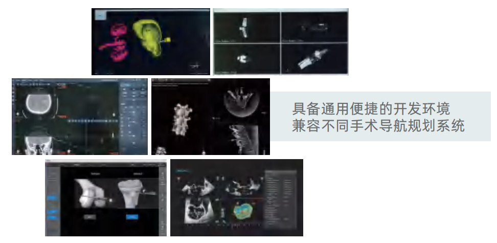 兼容不同手术导航规划系统.png